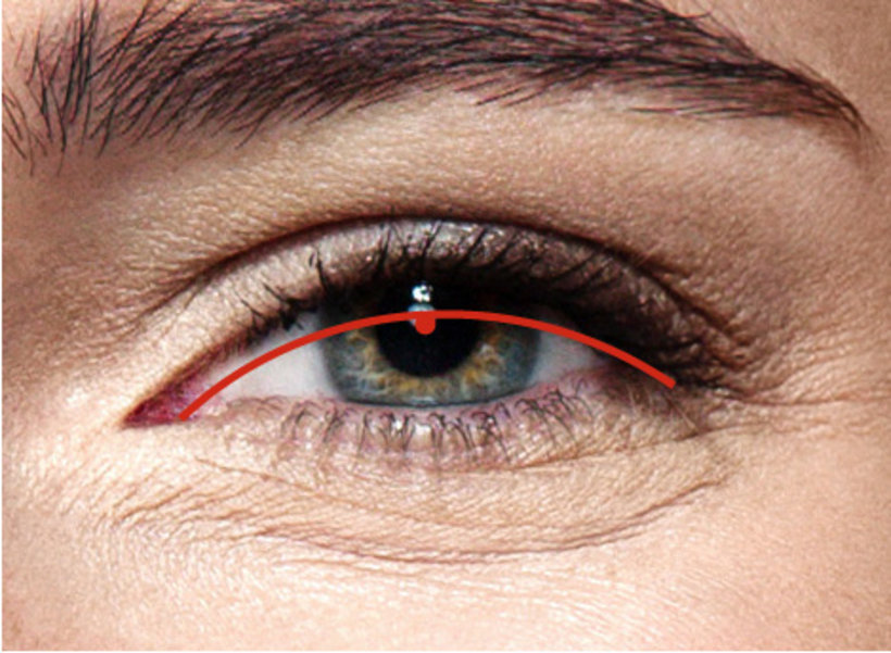 Medische indicatie ooglidcorrectie | Plastische Chirurgie Breda.jpg